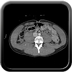 Clinical case 8 - Polytrauma due to a fall of a few meters following a loop while paragliding