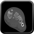Polytrauma due to a very high-speed single light vehicle road traffic accident  Head CT, Axial plane, Soft tissue window
