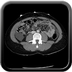 Clinical case 10 - Polytrauma due to road traffic accident, at 90 kmph, would appear to have been thrown over a bridge