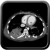 Clinical case 8 - Polytrauma due to a fall of a few meters following a loop while paragliding