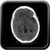 Clinical case 10 - Polytrauma due to road traffic accident, at 90 kmph, would appear to have been thrown over a bridge
