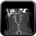 Clinical case 5 - Polytrauma due to road accident of single light vehicle against plane tree, not wearing seatbelt