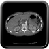 Clinical case 1 - Polytrauma due to road traffic accident, light vehicle against plane tree