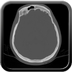 Clinical case 7 - Polytrauma due to road traffic accident, rear passenger, in hemorrhagic shock