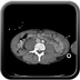 Clinical case 12 - Polytrauma with severe cranioencephalic trauma