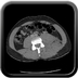Clinical case 3 - Polytrauma due to a fall from a height of 5 m