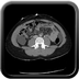 Clinical case 10 - Polytrauma due to road traffic accident, at 90 kmph, would appear to have been thrown over a bridge