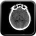 Clinical case 13 - Polytrauma due to a high-speed car accident (rear passenger with belt)