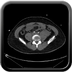 Clinical case 11 - Polytrauma due to a very high-speed single light vehicle road traffic accident
