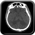 Clinical case 1 - Polytrauma due to road traffic accident, light vehicle against plane tree
