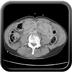 Clinical case 13 - Polytrauma due to a high-speed car accident (rear passenger with belt)