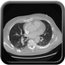 Clinical case 2 - AVP polytrauma high velocity