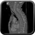 Clinical case 13 - Polytrauma due to a high-speed car accident (rear passenger with belt)