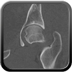 Clinical case 1 - Polytrauma due to road traffic accident, light vehicle against plane tree