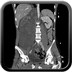 Clinical case 7 - Polytrauma due to road traffic accident, rear passenger, in hemorrhagic shock
