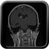 Progressive Headache rebellious to therapy   MRI Head Axial T1 FSE