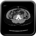 Clinical case 10 - Polytrauma due to road traffic accident, at 90 kmph, would appear to have been thrown over a bridge