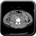 Clinical case 8 - Polytrauma due to a fall of a few meters following a loop while paragliding