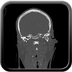 Clinical case 2 - AVP polytrauma high velocity
