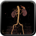 Polytrauma patient struck by a foal in a field Abdomen CT without inj