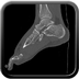 Clinical case 11 - Polytrauma due to a very high-speed single light vehicle road traffic accident