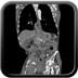 Hernie hiatale par roulement.  TDM Abdomen Axial Temps veineux