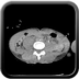 Clinical case 12 - Polytrauma with severe cranioencephalic trauma