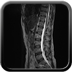 Traumatic perforation of small intestine, fracture of lumbar vertebra Head CT, Axial plane, Soft tissue window