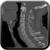 Clinical case 3 - Polytrauma due to a fall from a height of 5 m