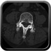 Lombalgies et claudication intermittente Sagittal (mou)