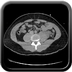 Clinical case 11 - Polytrauma due to a very high-speed single light vehicle road traffic accident