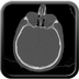 Clinical case 5 - Polytrauma due to road accident of single light vehicle against plane tree, not wearing seatbelt