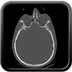 Clinical case 8 - Polytrauma due to a fall of a few meters following a loop while paragliding
