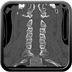 Clinical case 11 - Polytrauma due to a very high-speed single light vehicle road traffic accident