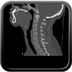 Clinical case 10 - Polytrauma due to road traffic accident, at 90 kmph, would appear to have been thrown over a bridge