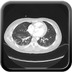 Clinical case 5 - Polytrauma due to road accident of single light vehicle against plane tree, not wearing seatbelt