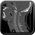Clinical case 12 - Polytrauma with severe cranioencephalic trauma