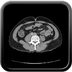 Clinical case 5 - Polytrauma due to road accident of single light vehicle against plane tree, not wearing seatbelt