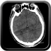 Clinical case 15 - Polytrauma due to road traffic accident, motorbike collided with light vehicle, front impact with no helmet