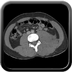 Clinical case 3 - Polytrauma due to a fall from a height of 5 m