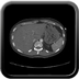 Clinical case 5 - Polytrauma due to road accident of single light vehicle against plane tree, not wearing seatbelt