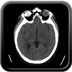 Clinical case 3 - Polytrauma due to a fall from a height of 5 m