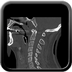 Clinical case 5 - Polytrauma due to road accident of single light vehicle against plane tree, not wearing seatbelt