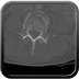 Clinical case 13 - Polytrauma due to a high-speed car accident (rear passenger with belt)
