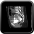 Clinical case 10 - Polytrauma due to road traffic accident, at 90 kmph, would appear to have been thrown over a bridge