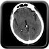 Clinical case 2 - AVP polytrauma high velocity