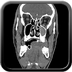 Clinical case 8 - Polytrauma due to a fall of a few meters following a loop while paragliding