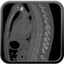 Clinical case 3 - Polytrauma due to a fall from a height of 5 m