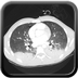 Clinical case 6 - Polytrauma severe cranial injury following road traffic accident