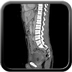 Clinical case 6 - Polytrauma severe cranial injury following road traffic accident